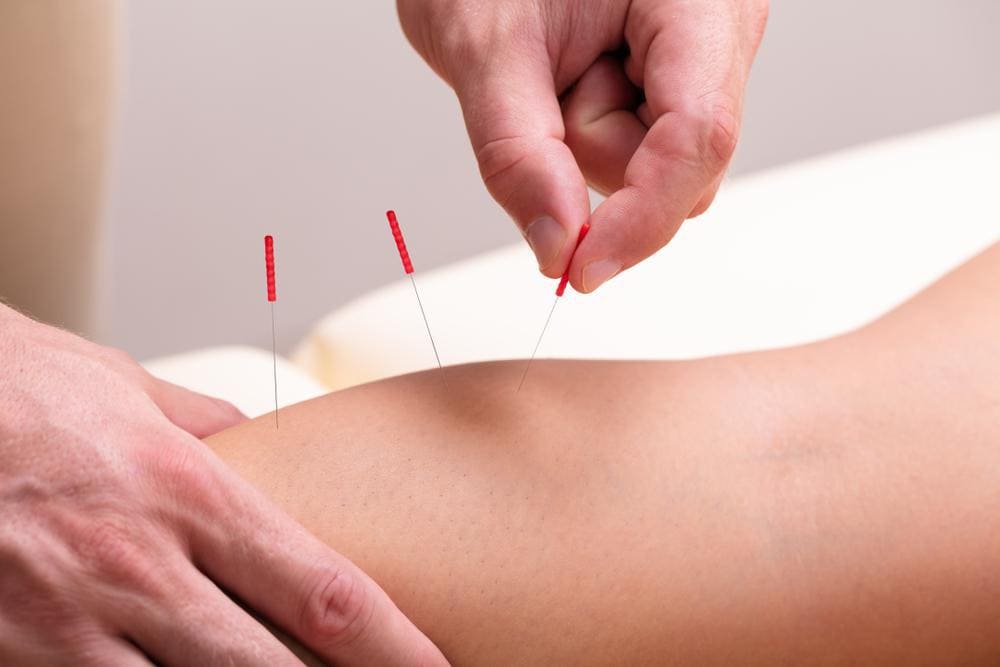 Knee pain acupuncture treatment